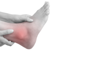 MUSCLE STRAINS JOINT SPRAINS fleurieu physiotherapy goolwa phsiotherapist